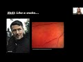 Diabetic Retinopathy Webinar Clinica London