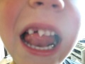 Ben's Tooth 3