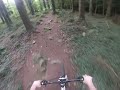 Bigwood Mtb Dirt Jumps