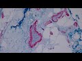 Immunohistochemistry in Normal Skin: p63, EMA, desmin, SMA, CD34, Factor XIIIa