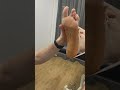Foot Low Dye Tape Technique