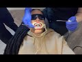 THE “BIG REVEAL” REMOVING MY BRACES! FINALLY CLOSED MY GAP! *entire process*