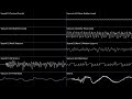 Sonic 4 Episode 2 Oscilloscope Deconstruction: A Duel with Metal Sonic (Stardust Speedway RMX)