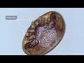 Varroa Mites Are a Honeybee's 8-Legged Nightmare | Deep Look