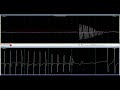 myotonic discharge