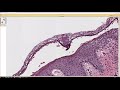 Infectious Dermpath (bacterial & fungal): Board Review for Dermatology & Pathology (20 cases)