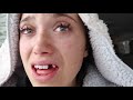 i got my front tooth & wisdom teeth removed (vlog + story)