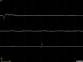 Fibs & psw firing regularly and then irregularly