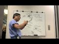 Approach to Skull Based Meningioma