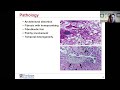 Interstitial Lung Disease for the General Internist