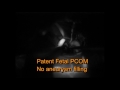 PCOM aneurysm clipping made miserable by Plavix induced thrombocytopathy