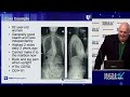 What's New in Spinal Deformity Surgery? - Christopher Shaffrey, M.D.