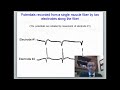 Teachable Moment: Spike Form Fibrillation Potentials and Positive Sharp Waves