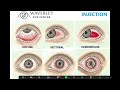 RED EYE: How to diagnose, differentiate and treat red eye & pink eye for primary care doctors