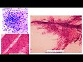 Pursue 7 Z C1 - Squash Cytology