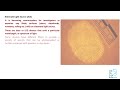 Fingerprint | Dactylography | Animation | Forensic Medicine | Identification