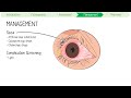 Sjogren Syndrome with mnemonics