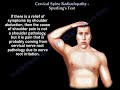 Cervical Spine Radiculopathy , Spurling's Test - Everything You Need To Know - Dr. Nabil Ebraheim