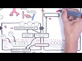 Vasculitis Pathophysiology Overview