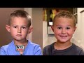 These Kids’ Lives Were Transformed by Plastic Surgery