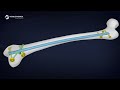 Mastering the RFN Retrograde Femoral Nailing System | Surgical Technique Animation