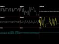 Sonic 3D Blast - Boss - Oscilloscope Deconstruction