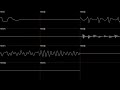 Crash Bandicoot (PS1) - Hog Wild - Oscilloscope Deconstruction