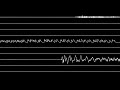 Nine Inch Nails - 1,000,000 (Oscilloscope)