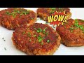 Vegan Lentil Burger Recipe | How To Make Lentil Burgers | The Best Lentil Recipe Ever!