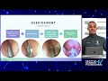 Key Things To Do in the Last Ten Minutes of Sinus Surgery & in the Post Op Period? - Arif Janjua, MD