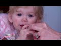 Meet 1-Year-Old Who’s Allergic to Tears