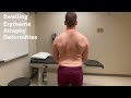 Rheumatology BACK exam Part 2: Inspection