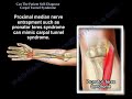 Patient Self Diagnose Carpal Tunnel Syndrome - Everything You Need To Know - Dr. Nabil Ebraheim