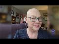 Cancer Patient Story: My Non-Hodgkin Lymphoma (DLBCL) 1st Symptoms & Diagnosis | Barbara (1 of 3)