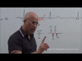 ECG | QRS Complex in EKG | Nomenclature | Electrocardiography🫀