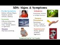 Antidepressant Discontinuation Syndrome | Medications, Signs & Symptoms, Diagnosis, Treatment