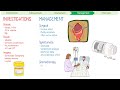 Carcinoid Syndrome in 3 Minutes