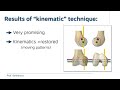New game changing knee replacement technique explained - 
