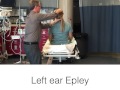 BPPV Dix Hallpike Test and Epley Maneuver