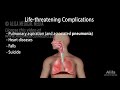 Huntington's Disease, Genetics, Pathology and Symptoms, Animation