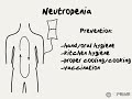 Doctor Explains Neutropenia During Chemotherapy