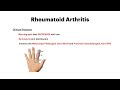 Osteoarthritis vs. Rheumatoid Arthritis