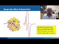 Needle EMG: normal vs neuropathic MUPs