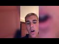 Justin Bieber CAN'T SING LIVE ANYMORE (Exposed)