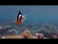 Immersion Healing: Underwater Relaxing  Music For Deep Stress Relief.