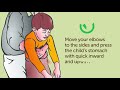 How to Help a Choking Child or Adult (Everyone Must Know!)