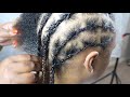 NEW TECHNIQUE | ALOPECIA | FINE HAIR | HAIR LOSS | BOX BRAIDS | DEDE AT HOME