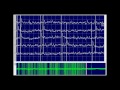 Kimura & Kohara: F6 EP noise and EP spike