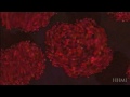 Anemia Falciforme ou Drepanocitose (HHMI Biointeractive)