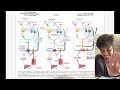 Iron Metabolism and Iron Deficiency Anemia | Plummer Vinson Syndrome - Biochem & Pathology MBBS IOM